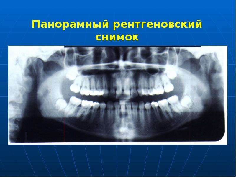 Презентация клинического плана пациенту эстетическая стоматология