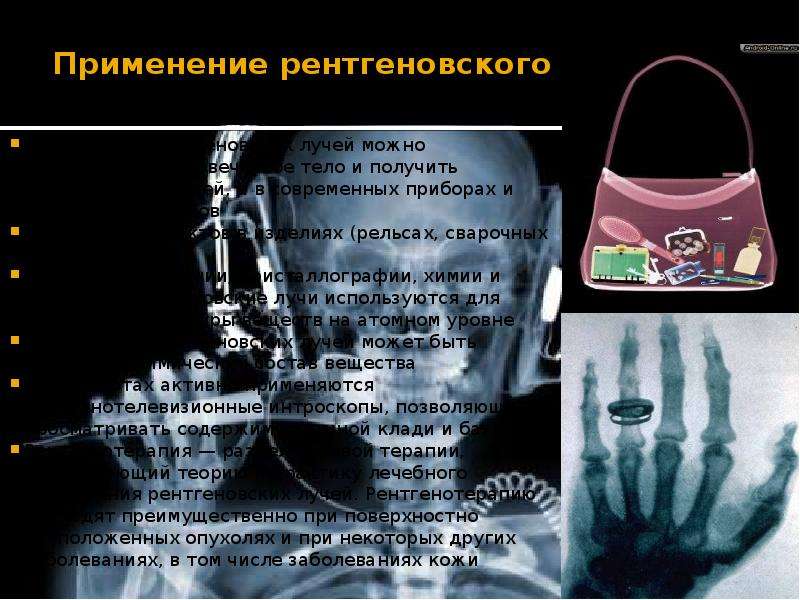 Применение рентгеновского излучения в медицине проект