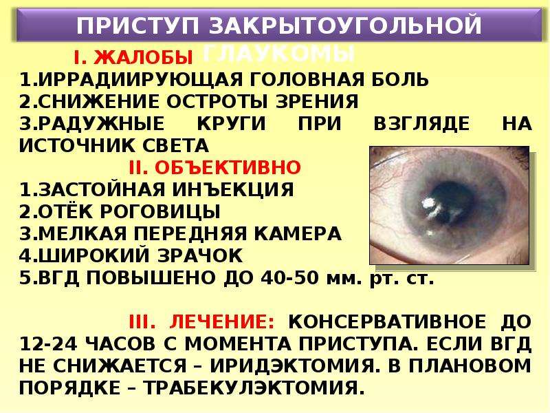 Что нельзя делать при глаукоме. Профилактика приступа глаукомы. Презентация на тему глаукома. Приступ закрытоугольной глаукомы.