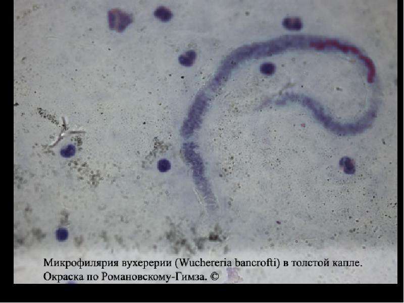 Бактерии в копрограмме. Копрология кала микроскопия. Микрофиллярии вухерерии.
