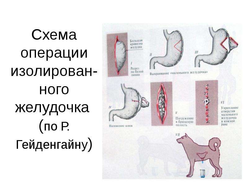 Схема операции изолированного желудочка по гейденгайну и по павлову