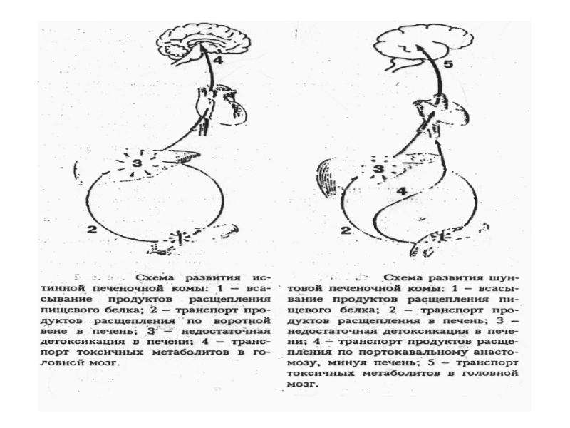 Печень патофизиология презентация