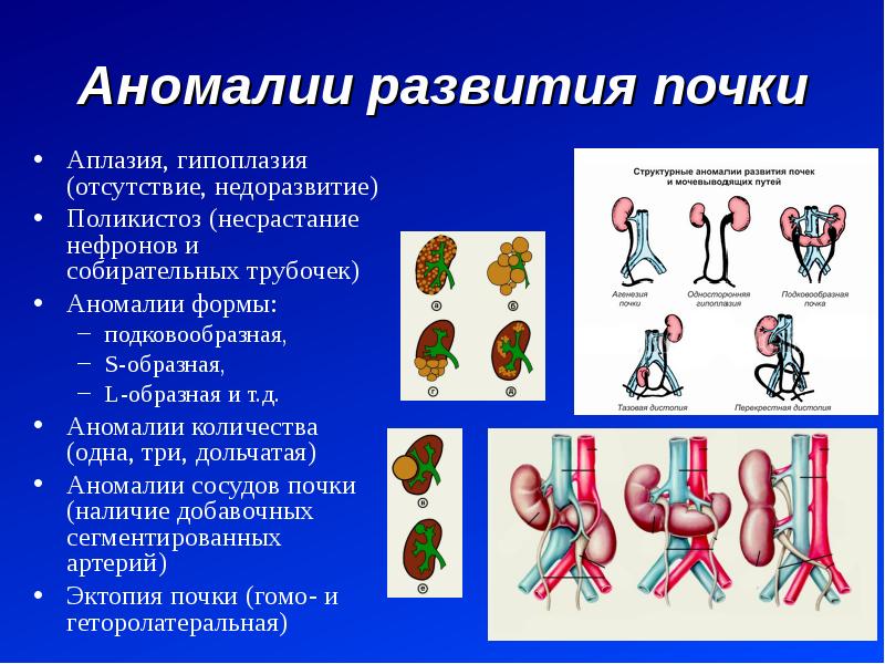 Аплазия это в медицине