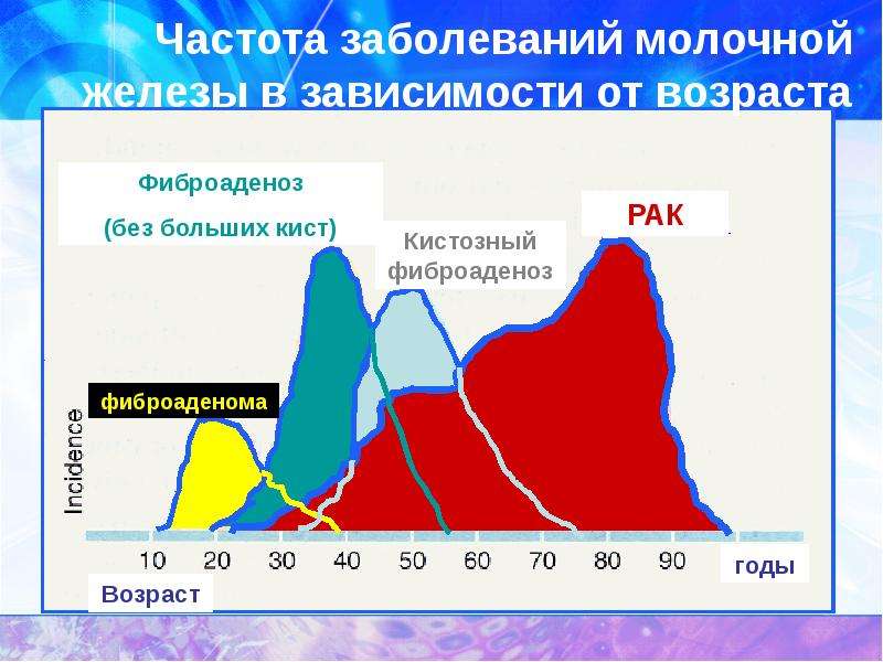 Частота заболеваний. Статистика заболеваний молочной железы. Статистика заболеваемости онкологией молочных желез. Заболевания молочных желез статистика.