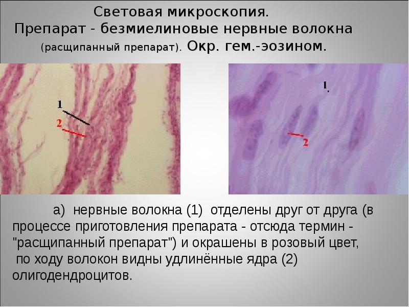 Безмиелиновые нервные волокна гистология рисунок