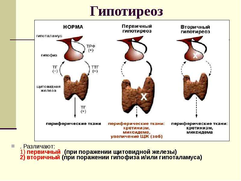 Щитовидная железа у детей презентация