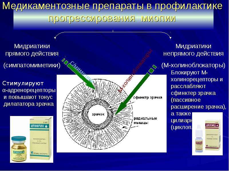 Проект на тему близорукость