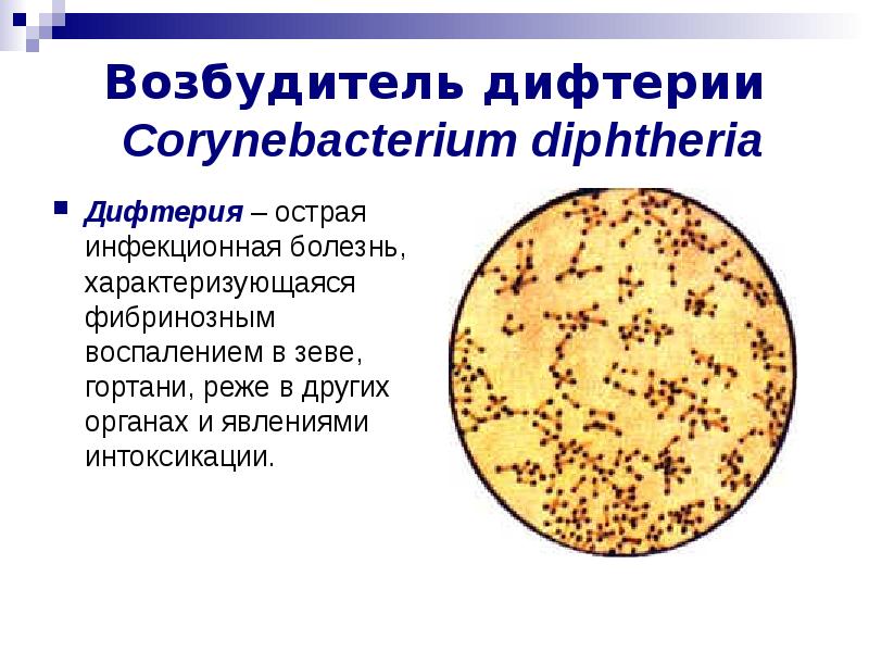 Острая инфекционная болезнь характеризующаяся. Возбудитель дифтерии источник инфекции. Дифтерия очаг поражения. Дифтерия возбудитель симптомы. Corynebacterium diphtheriae микробиология.