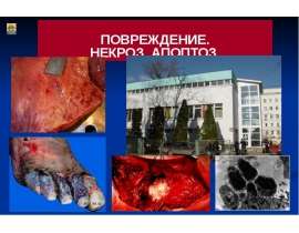 Повреждение некроз