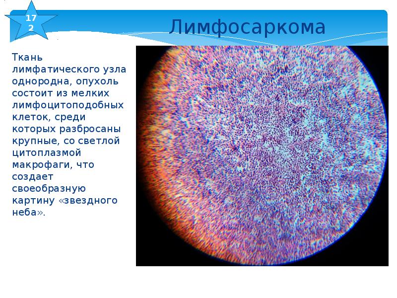 Симптом картина звездного неба