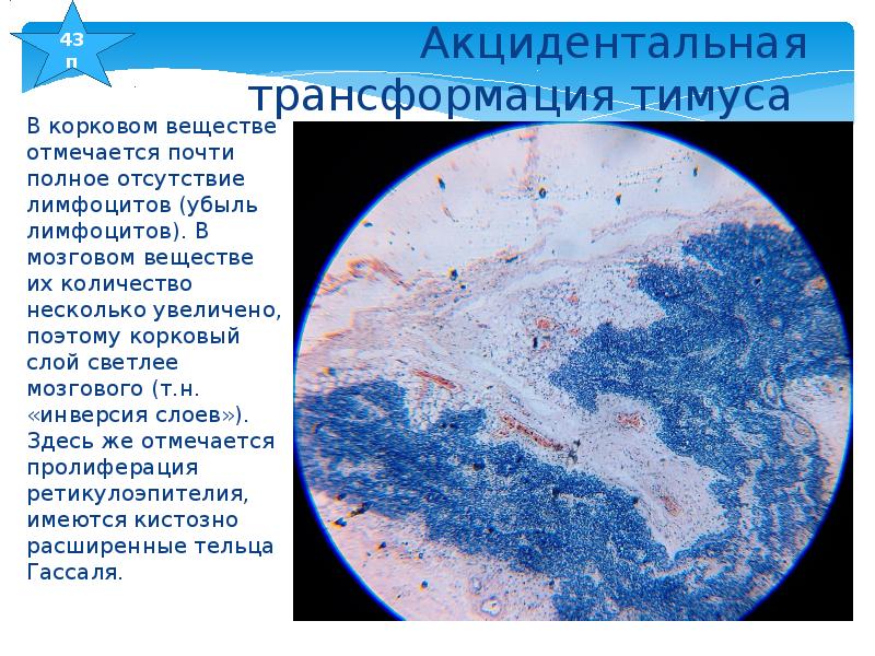 Акцидентальная инволюция тимуса