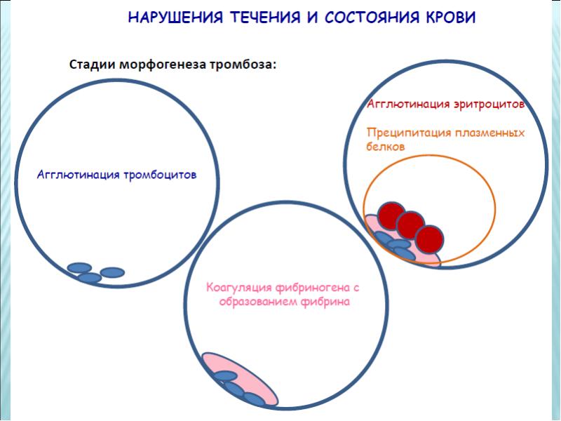 Механизмы нарушения лимфообращения схема