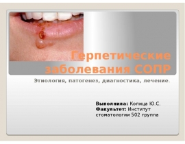 Герпетические заболевания СОПР