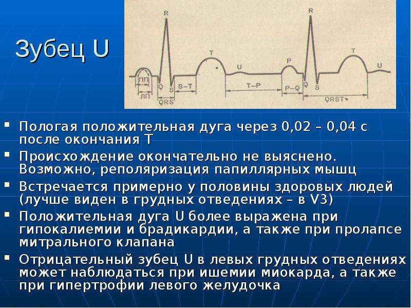 Физические основы электрокардиографии презентация