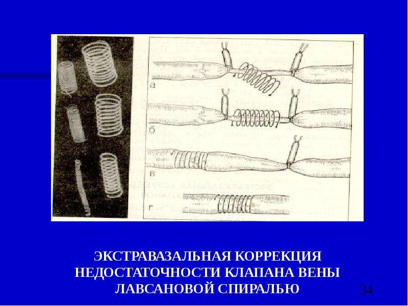 Экстравазальная компрессия артерий