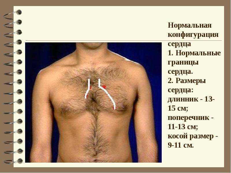 Размеры сердца. Длинник и поперечник сердца. Конфигурацию, длинник и поперечник сердца.. Размеры сердца длинник поперечник. Нормальная конфигурация сердца границы.