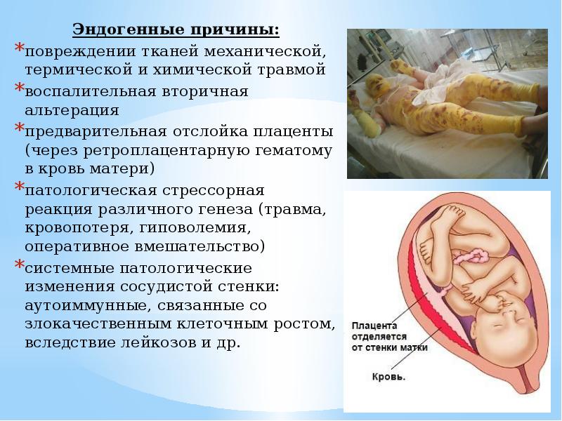 Корсаковский синдром презентация