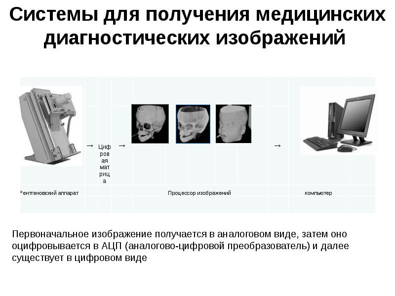 Аналоговое изображение. Системы для получения медицинских диагностических изображений. Аналоговые и цифровые медицинские изображения. Аппаратно-компьютерные медицинские системы. Виды диагностических изображений.