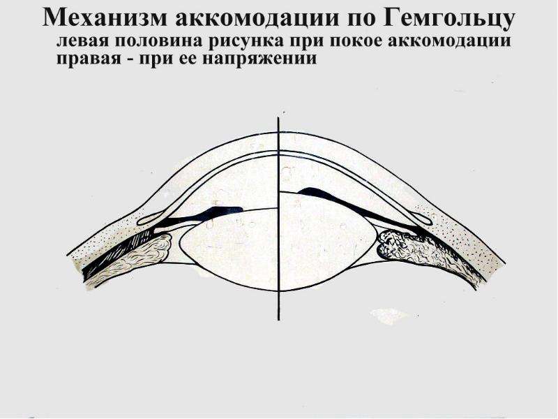 Схема механизма аккомодации