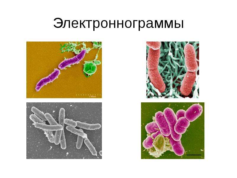 Возбудители кишечных инфекций микробиология презентация