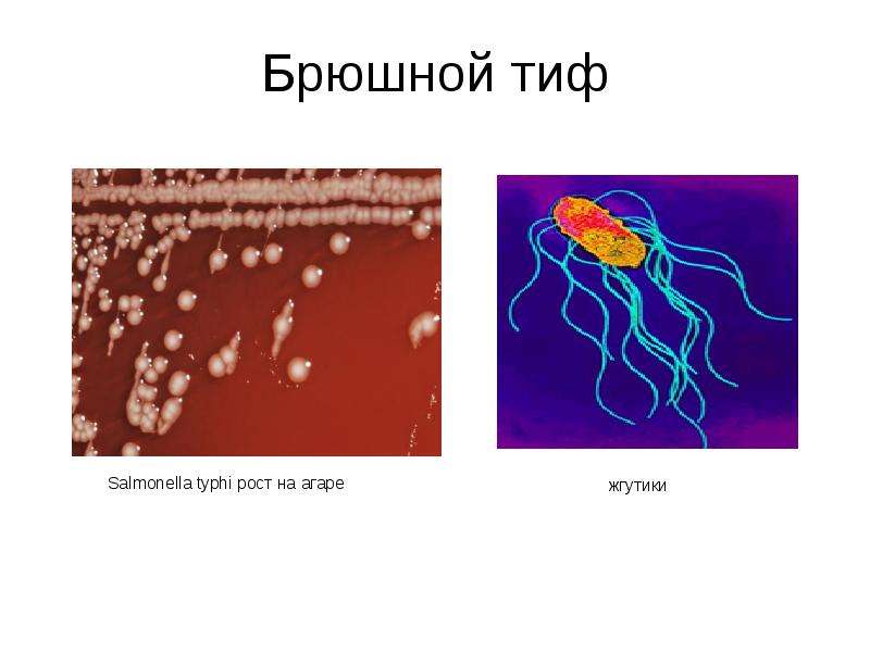 Брюшной тиф кишечные. Возбудитель брюшного тифа. Сальмонелла Тифи жгутики. Возбудитель брюшного тифа палочка. Брюшной тиф сальмонелла Тифи.