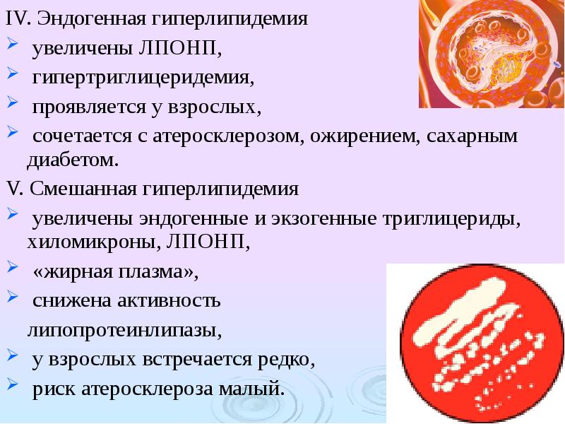 Атеросклероз при диабете. Ожирение и атеросклероз. Комбинированная гиперлипидемия. Гипертриглицеридемия и ожирение. Смешанная гиперлипидемия что это такое.