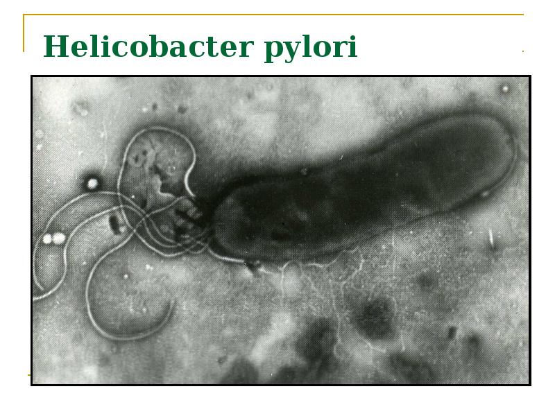 Helicobacter pylori фото