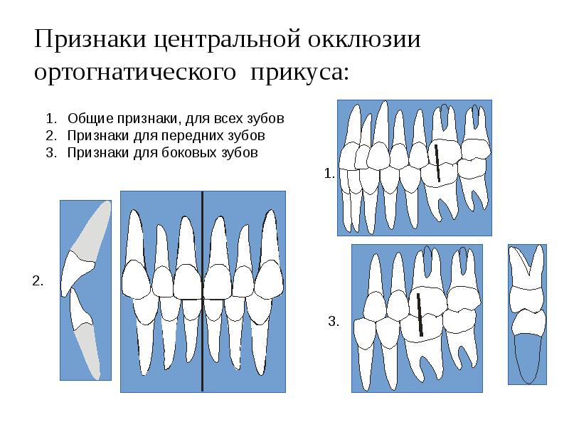 Центральная окклюзия и центральное соотношение. Центральная окклюзия вид сбоку. Зубные признаки центральной окклюзии. Центральная окклюзия признаки центральной окклюзии. Признаки центральной окклюзии при ортогнатическом прикусе.