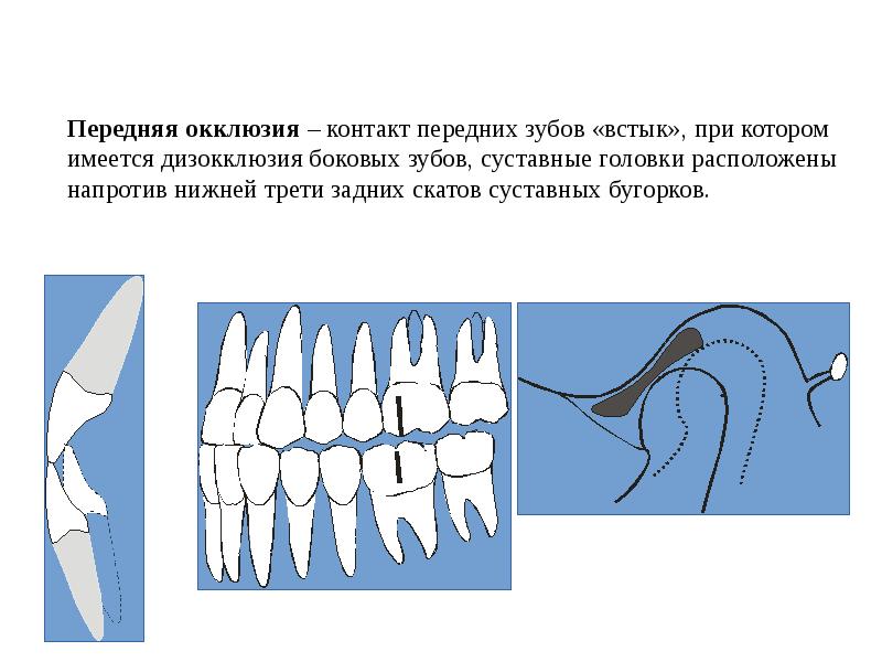 Формы окклюзии