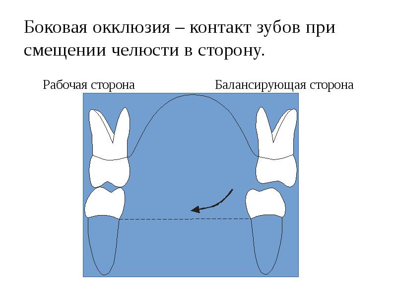 Внутренняя окклюзия