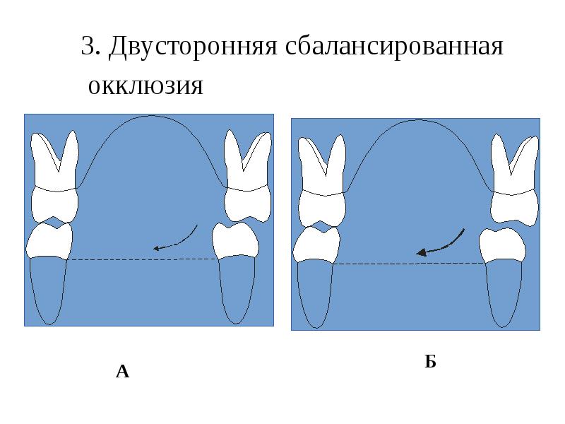 Окклюзия оба