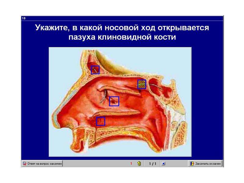 Носовая полость стенки носовые ходы и их сообщения с околоносовыми пазухами