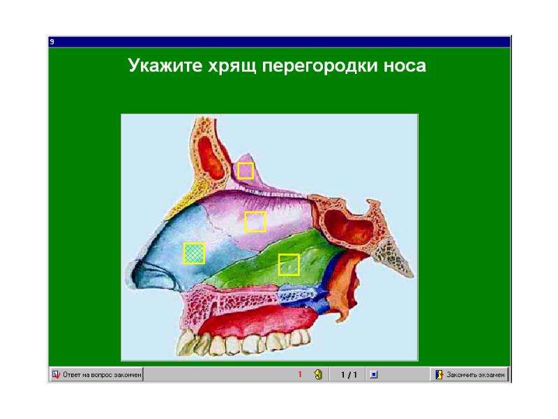 Как называется стенка между ноздрями