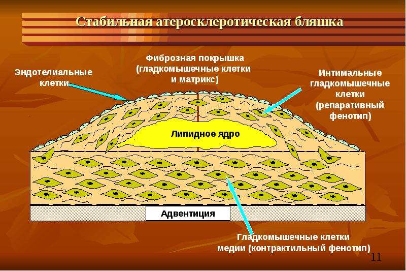 Гипотиреоз терапия презентация