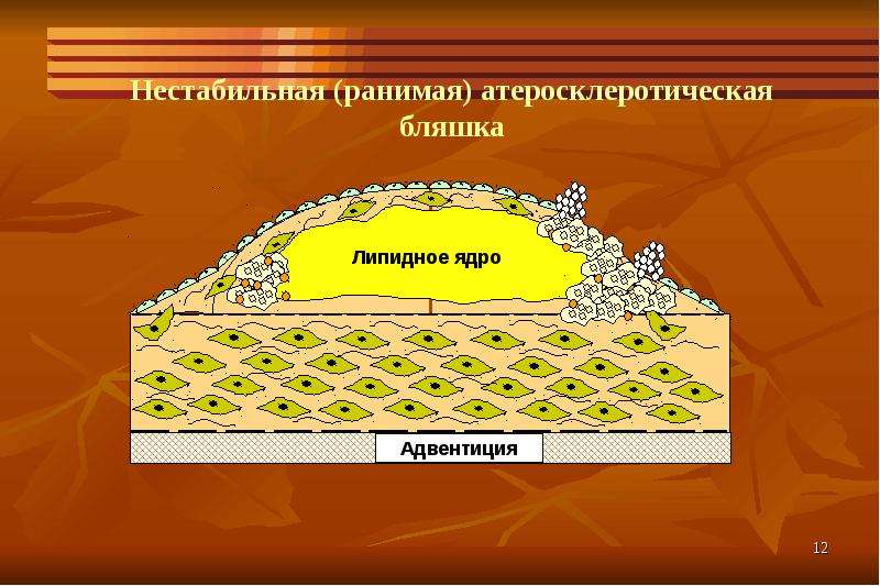 Гипотиреоз терапия презентация