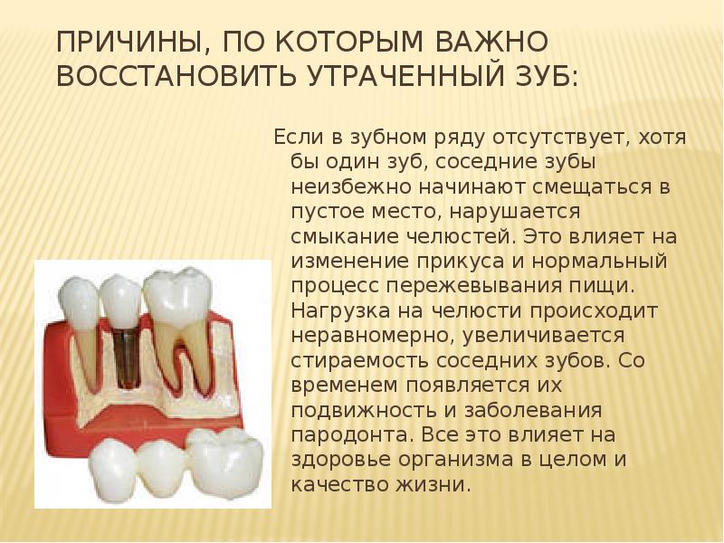 История имплантации зубов презентация