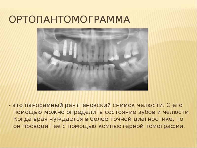 Схема описания ортопантомограммы