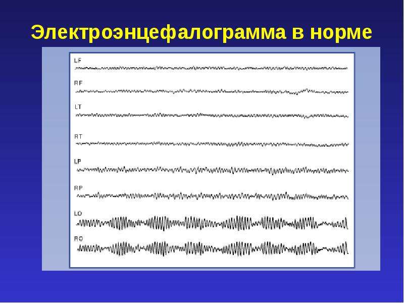 Ээг картинка для презентации