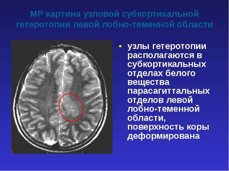 Мр картина что это