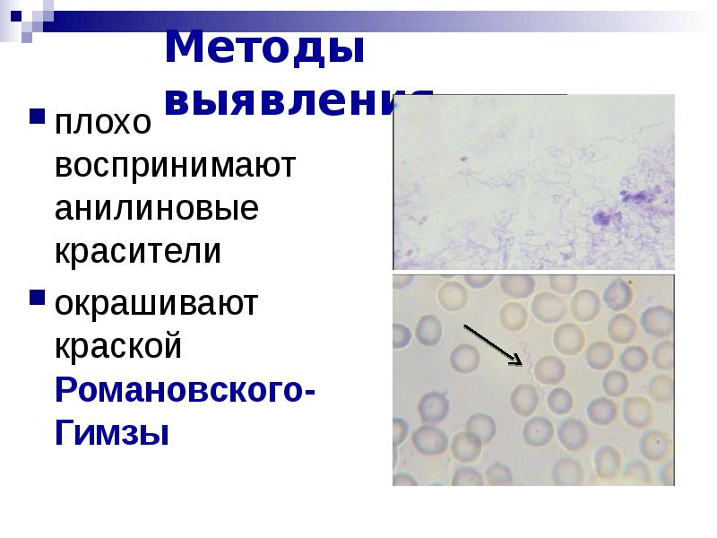 Окраска мазка по романовскому гимза