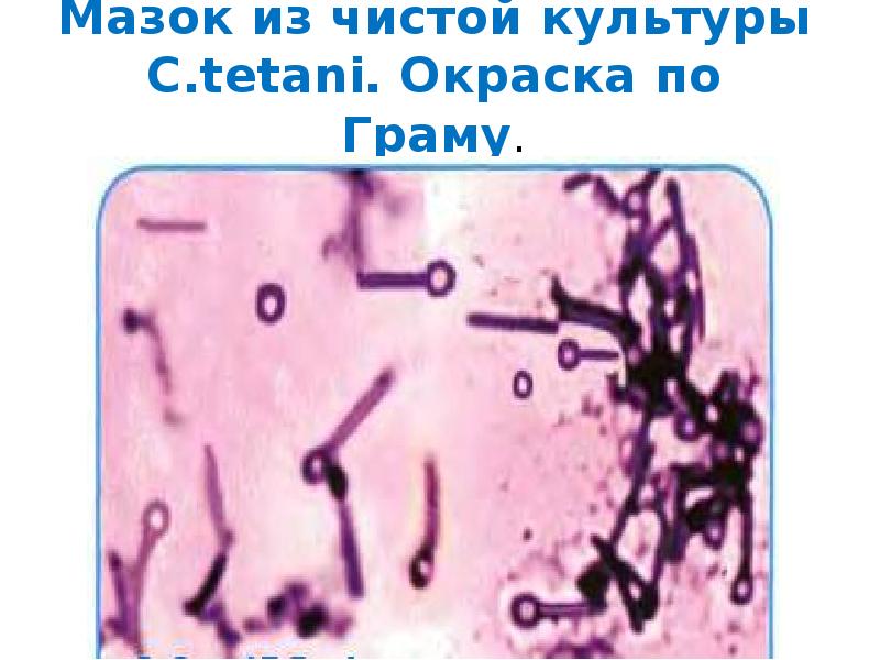 Анаэробные условно патогенные. Актиномицеты мазок по Граму. Патогенные анаэробы окраска по Граму. Анаэробы микробиология.