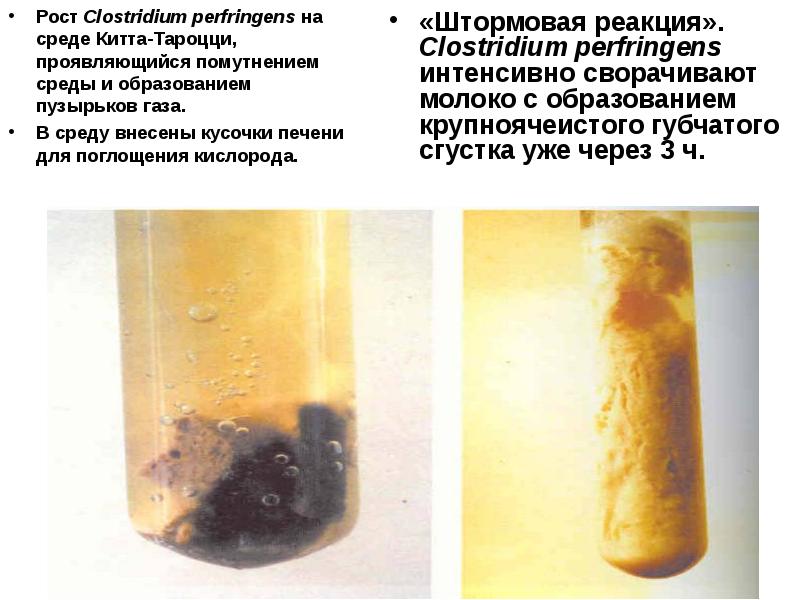 Характер роста. Среда для клостридии перфрингенс. Среда Вильсона Блера клостридии. Среда Вильсона Китта Тароцци. Рост клостридий на среде.