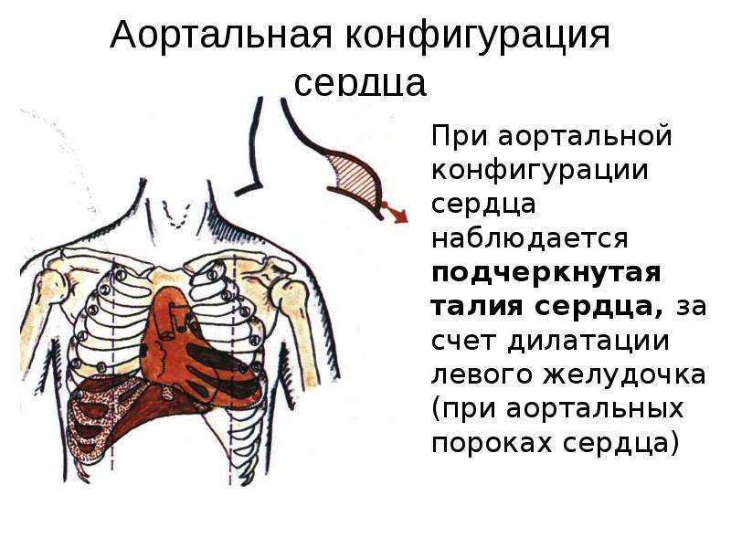 Перкуссия для фона