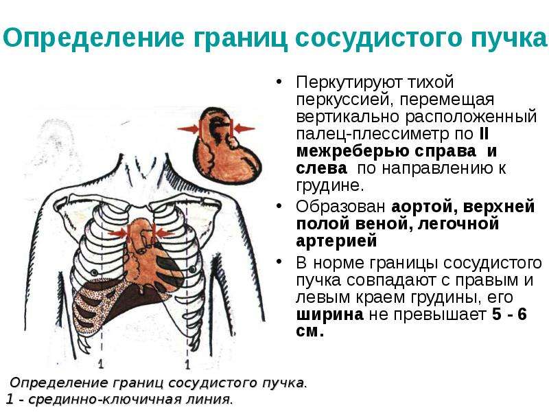 Перкуссия сердца в картинках