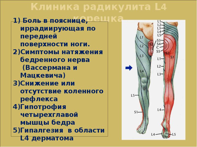 Бедренный нерв симптомы