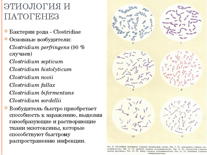 Этиология и патогенез Бактерии рода - Clostridiae Основные возбудители: Clostridium perfringens (90