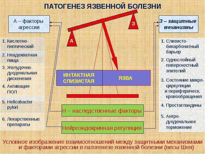 Болезни весов. Язвенная болезнь этиология и патогенез. Этиология язвенной болезни желудка. Патогензязвенной болезни. Патогенез язвенной болезни желудка.