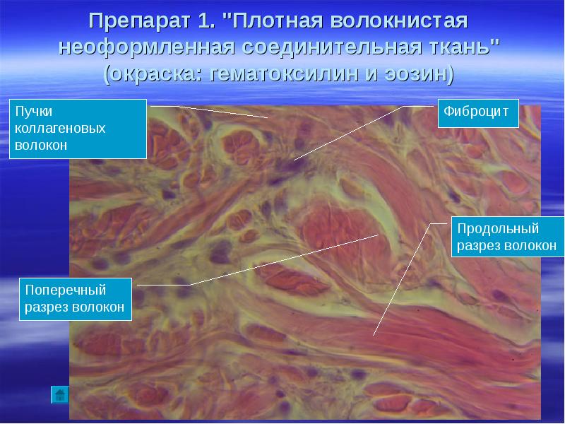 Препараты тканей. Плотная неоформленная соединительная ткань препарат гистология. Плотная волокнистая неоформленная соединительная ткань гистология. Плотная волокнистая неоформленная соединительная ткань препарат. Плотная волокнистая неоформленная соединительная ткань функции.