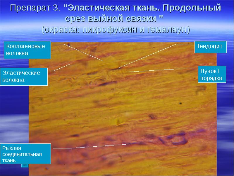 Эластическая связка. Эластичная плотная неоформленная соединительная ткань. Плотная оформленная соединительная ткань эластическая связка. Плотная волокнистая соединительная ткань эластического типа. Плотная соединительная ткань связки гистология.