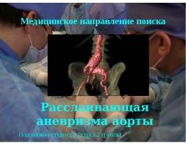 Расслаивающая аневризма аорты